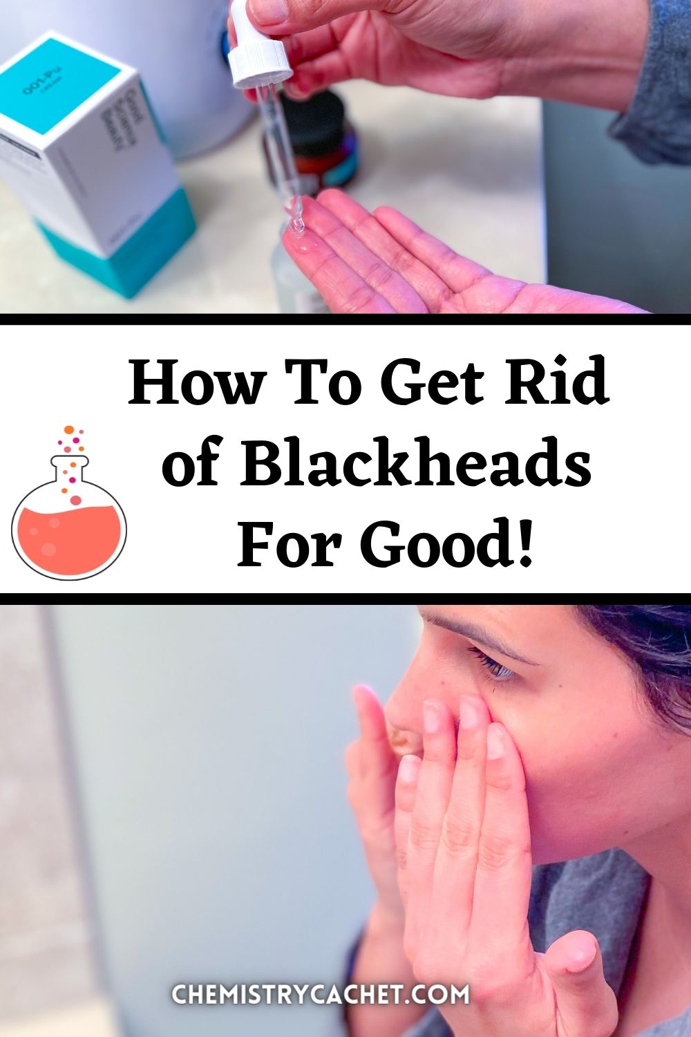 How To Get Rid of Blackheads For Good