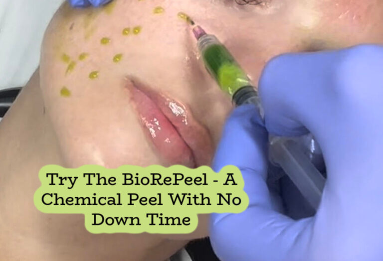 The BioRePeel – A Chemical Peel With No Down Time