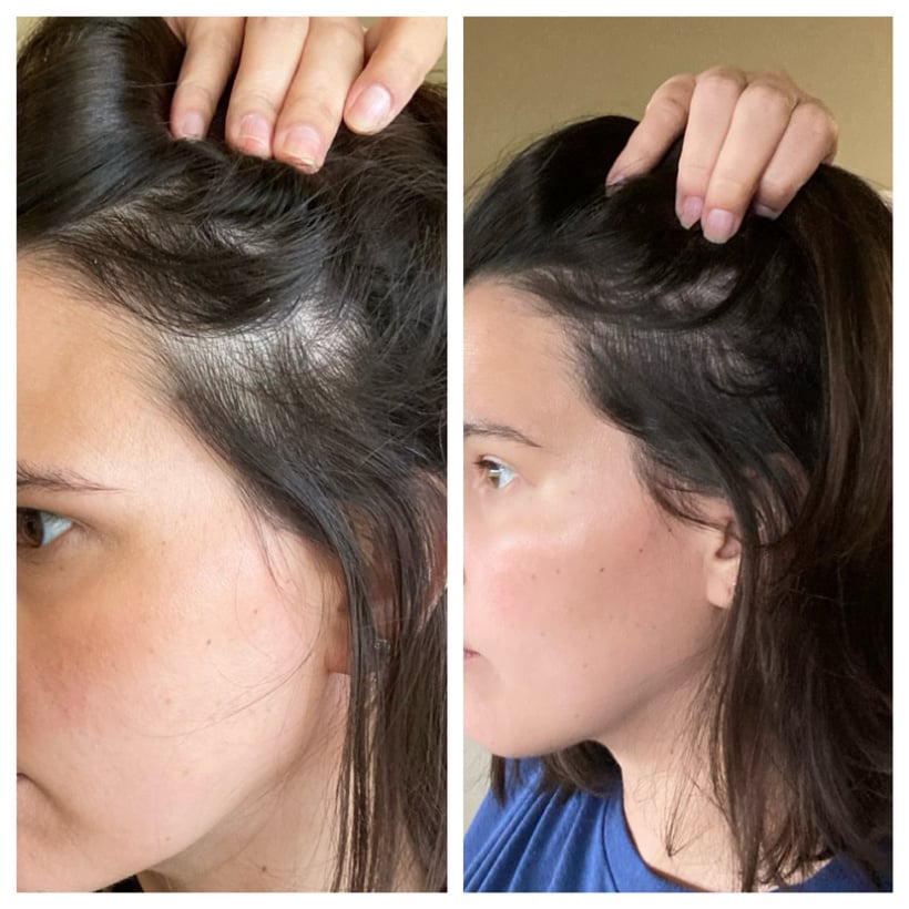 liquid collagen grows hair